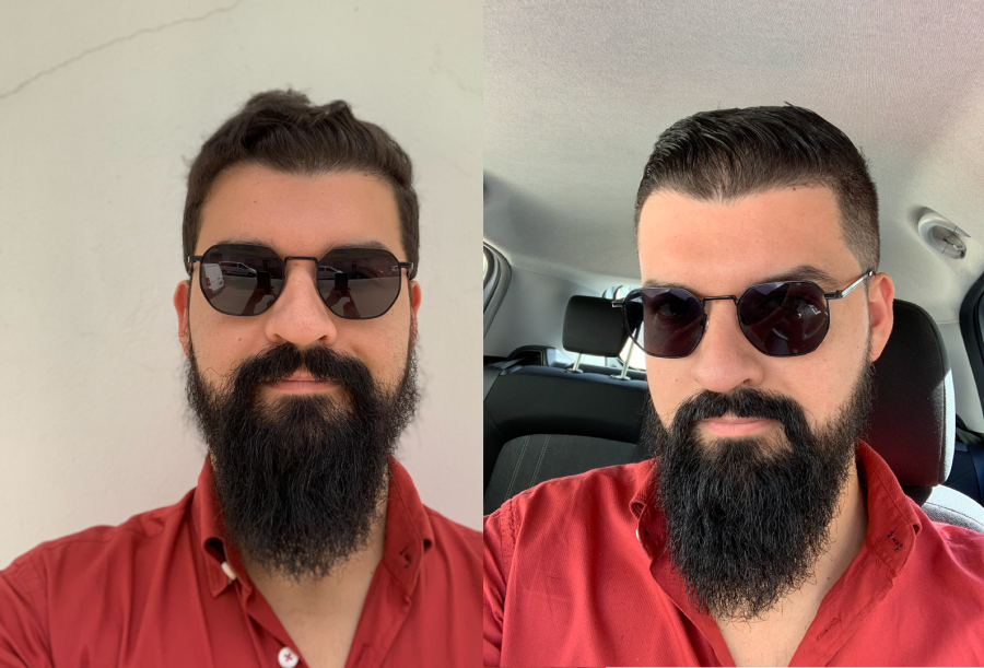 antes e depois